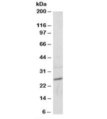 Western blot testing of mouse heart lysate at 2ug/ml. Predicted molecular weight: ~25kDa.