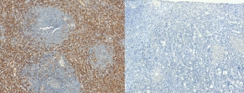 IHC staining of FFPE human spleen tissue with AIF-1 antibody (left) and without AIF-1 antibody (right, negative control). Required HIER: steamed antigen retrieval with pH6 citrate buffer.