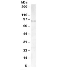 Western blot testing of human testis lysate with AKAP3 antibody at 1ug/ml. Predicted molecular weight: ~95kDa.
