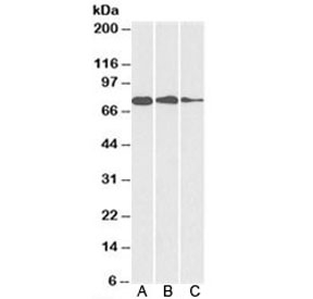 Western blot testing of A) HepG2, B) HeLa and C) MCF7 cell lysate with GRP78 antibody at 0.1ug/ml. Predicted molecular weight: ~73 kDa, routinely observed at 70-78 kDa.