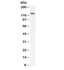 Western blot testing of human ovary lysate with NALP5 antibody at 2ug/ml. Predicted molecular weight ~134 kDa.