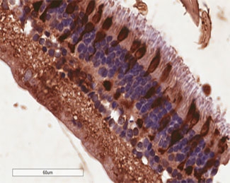 IHC testing of FFPE human retina with Arrestin 3 antibody at 4ug/ml. HIER: steamed with pH6 citrate buffer, HRP-staining. Staining of the outer segments of rod receptor cells is seen.