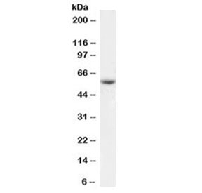 Western blot testing of human placenta lysate with Kynurenine 3 monooxygenase antibody at 1ug/ml. Predicted molecular weight: 52-56 kDa (multiple isoforms).