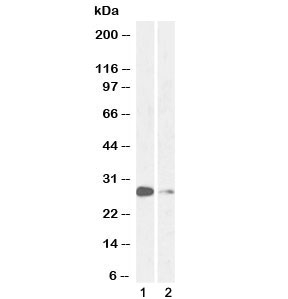 Western blot testing of 1) mouse lung and 2) rat lung lysate with MASH1 antibody at 1ug/ml. Predicted molecular weight ~25 kDa.