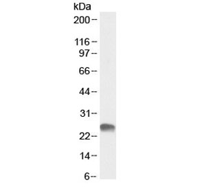 Western blot testing of human placental lysate with GSTA3 antibody at 0.3ug/ml. Predicted molecular weight ~25 kDa.