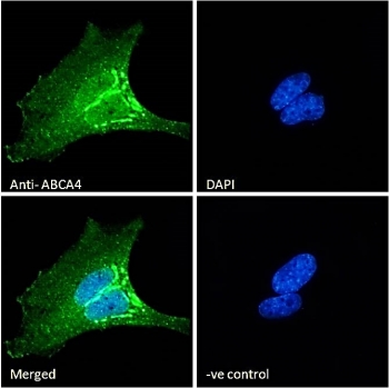 Immunofluorescent staining of fixed and permeabilized human HeLa cells with ABCA4 antibody (green) at 10ug/ml and DAPI nuclear stain (blue).