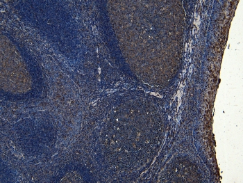 IHC staining of FFPE human tonsil tissue with SOX2 antibody at 8ug/ml. Required HIER: steamed antigen retrieval with pH6 citrate buffer; HRP-staining.