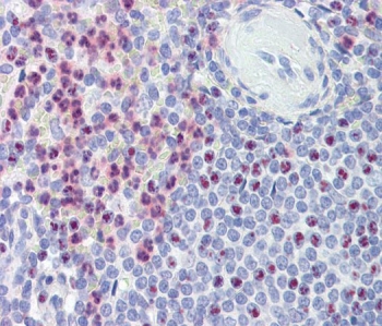 IHC staining of FFPE human spleen tissue with Polycystin 1 antibody. Required HIER: steamed antigen retrieval with pH6 citrate buffer; AP-staining.