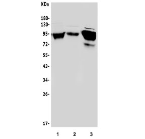 Western blot testing of human 1) Raji, 2) K562 and 3) HepG2 cell lysate with ICAM1 antibody at 0.5ug/ml. Predicted molecular weight: ~58 kDa (unmodified), 75-115 kDa (glycosylated).