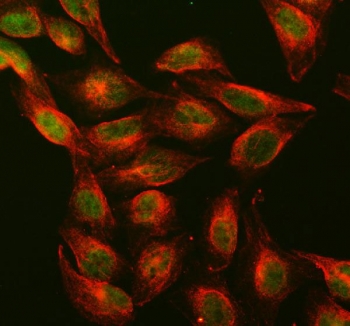 Immunofluorescent staining of FFPE human U-2 OS cells with Dnmt1 antibody (green) and Alpha Tubulin mAb (red). HIER: steam section in pH6 citrate buffer for 20 min.