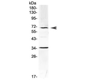 Western blot testing of mouse HEPA1-6 cell lysate with Alpha 1 Fetoprotein antibody at 0.5ug/ml. Predicted molecular weight ~67 kDa.