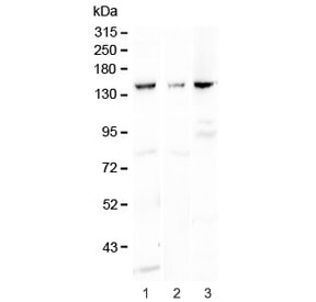 Western blot testing of 1) rat kidney, 2) mouse liver and 3) mouse HEPA1-6 lysaste with VEGF Receptor 1 antibody at 0.5ug/ml. Predicted molecular weight ~150 kDa but may be observed at higher molecular weights due to glycosylation.