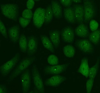 Immunofluorescent staining of FFPE human SiHa cells with PER1 antibody (green). HIER: steam section in pH6 citrate buffer for 20 min.