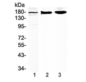 Western blot testing of 1) human placenta, 2) rat brain and 3) mouse brain lysate with SUR1 antibody at 0.5ug/ml. Predicted molecular weight ~177 kDa.