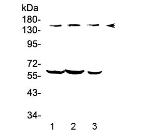Western blot testing of human 1) COLO-320, 2) HepG2 and 3) A549 lysate with KCNH1 antibody at 0.5ug/ml. Predicted molecular weight ~111 kDa (may be observed larger than predicted due to glycosylation).