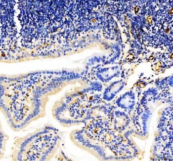 IHC staining of FFPE mouse colon tissue with CD31 antibody. HIER: boil tissue sections in pH8 EDTA for 20 min and allow to cool before testing.