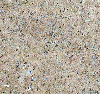 IHC staining of FFPE rat brain tissue with Neuropeptide S antibody. HIER: boil tissue sections in pH8 EDTA for 20 min and allow to cool before testing.