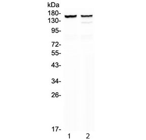 Western blot testing of 1) rat heart and 2) mouse heart lysate with MYBPC3 antibody at 0.5ug/ml. Predicted molecular weight ~141 kDa.