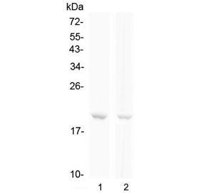 Western blot testing of human 1) Raji and 2) Jurkat cell lysate with BCMA antibody at 0.5ug/ml. Expected molecular weight: 20-27 kDa depending on glycosylation level.