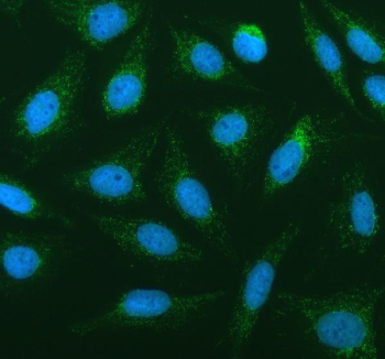 Immunofluorescent staining of FFPE human U-2 OS cells with PLA2G6 antibody (green) and DAPI nuclear stain (blue). HIER: steam section in pH6 citrate buffer for 20 min.