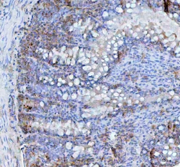 IHC staining of FFPE rat intestine tissue with BCMA antibody. HIER: boil tissue sections in pH8 EDTA for 20 min and allow to cool before testing.