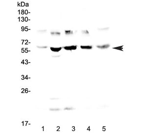 Western blot testing of human 1) HeLa, 2) placenta, 3) MCF7, 4) HepG2 and 5) PANC-1 lysate with Steroid sulfatase antibody at 0.5ug/ml. Predicted molecular weight ~65 kDa.
