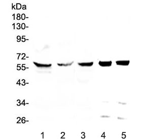 Western blot testing of human 1) HeLa, 2) HepG2, 3) MDA-MB-231, 4) rat testis and 5) mouse testis lysate with TCP1 eta antibody at 0.5ug/ml. Predicted molecular weight: ~59 kDa.