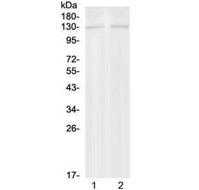 Western blot testing of 1) rat brain and 2) mouse brain with PSD antibody at 0.5ug/ml. Predicted molecular weight ~109 kDa.