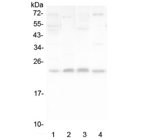 Western blot testing of human 1) placenta, 2) SMMC-7721, 3) A375 and 4 A431 lysate with LMO2 antibody at 0.5ug/ml. Predicted molecular weight ~18 kDa (isoform 1), ~25 kDa (isoform 3).