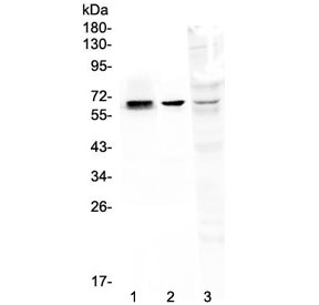 Western blot testing of 1) rat kidney, 2) mouse kidney and 3) human MDA-MB-231 lysate with COBRA1 antibody at 0.5ug/ml. Predicted molecular weight ~66 kDa.