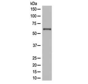 Western blot testing of human JAR cell lysate with NOX4 antibody at 0.5ug/ml. Expected molecular weight: ~65 kDa, 75-80 kDa.