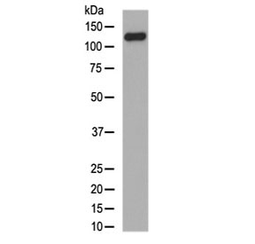 Western blot testing of human skin lysate with Collagen XVII antibody at 0.5ug/ml. Expected molecular weight ~120 kDa and ~180 kDa.