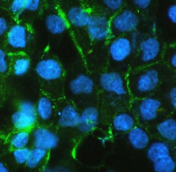 Immunofluorescent testing of FFPE human A431 cells with Beta Catenin antibody. HIER: boil tissue sections in pH6, 10mM citrate buffer, for 10-20 min followed by cooling at RT for 20 min.