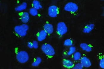 Western blot testing of human 1) placenta, 2) A549, 3) K562, 4) HL-60, 5) MCF-7 and 6) Caco-2 cell lysate with GM130 antibody at 0.5ug/ml. Predicted molecular weight ~130 kDa.