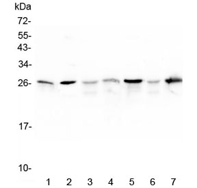 Western blot testing of 1) rat skeletal muscle, 2) rat lung and mouse 3) spleen, 4) skeletal muscle, 5) lung, 6) liver and 7) testis lysate with Hsp27 antibody at 0.5ug/ml. Predicted molecular weight: 23-27 kDa.