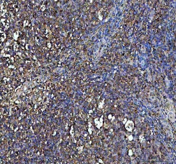 IHC staining of FFPE human tonsil tissue with IFNG antibody. HIER: boil tissue sections in pH8 EDTA for 20 min and allow to cool before testing.