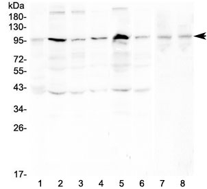 Western blot testing of human 1) placenta, 2) HeLa, 3) PC-3, 4) A431, 5) K562, 6) PANC-1, 7) rat testis and 8) mouse testis with RSK3 antibody at 0.5ug/ml. Expected molecular weight ~90 kDa.