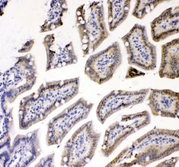 IHC staining of FFPE mouse colon tissue with TNF Receptor antibody. HIER: boil tissue sections in pH8 EDTA for 20 min and allow to cool before testing.