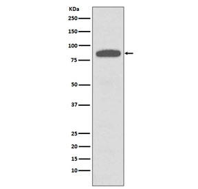 Western blot testing of human A431 cell lysate with IKK alpha/beta antibody. Predicted molecular weight ~85 kDa.