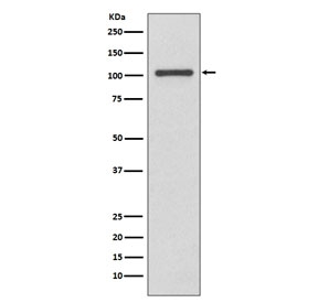 Western blot testing of human MCF7 cell lysate with INPP4B antibody. Predicted molecular weight ~105 kDa.