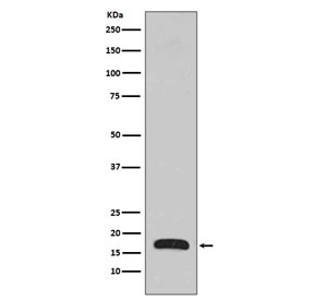 Western blot testing of human fetal brain lysate with p16 ARC antibody. Predicted molecular weight ~16 kDa.