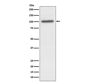 Western blot testing of human A431 cell lysate with ACTN4 antibody. Predicted molecular weight ~105 kDa.