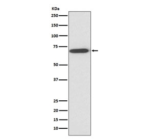 Western blot testing of human fetal liver lysate with Perilipin 1 antibody at 0.5ug/ml. Expected molecular weight: 56-62 kDa.
