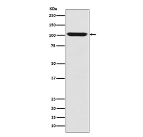 Western blot testing of human fetal skeletal muscle with GPR49 antibody. Predicted molecular weight ~100 kDa.
