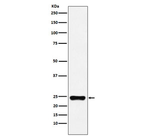 Western blot testing of human HeLa cell lysate with BAG2 antibody. Predicted molecular weight ~22 kDa.