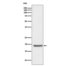 Western blot testing of human Jurkat cell lysate with SOD1 antibody. Predicted molecular weight ~16 kDa.