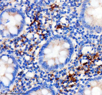 IHC staining of FFPE human appendix tissue with Factor XIIIa antibody, HRP-secondary and DAB substrate. HIER: boil tissue sections in pH8 EDTA for 20 min and allow to cool before testing.