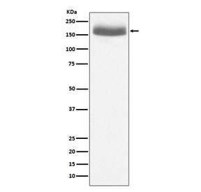 Western blot testing of human urine protein lysate with EGF antibody. Predicted molecular weight: ~134 kDa but routinely observed at 134-160 kDa.