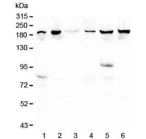 Western blot testing of human 1) placenta, 2) T-47D, 3) U-2 OS, 4) K562, 5) ThP-1 and 6) monkey COS-7 lysate with CPAMD8 antibody at 0.5ug/ml. Predicted molecular weight ~207 kDa.