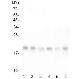 Western blot testing of human 1) HeLa, 2) T-47D, 3) HepG2, 4) K562, 5) mouse liver and 6) mouse HEPA1-6 lysate with RMI2 antibody at 0.5ug/ml. Expected molecular weight ~18 kDa.